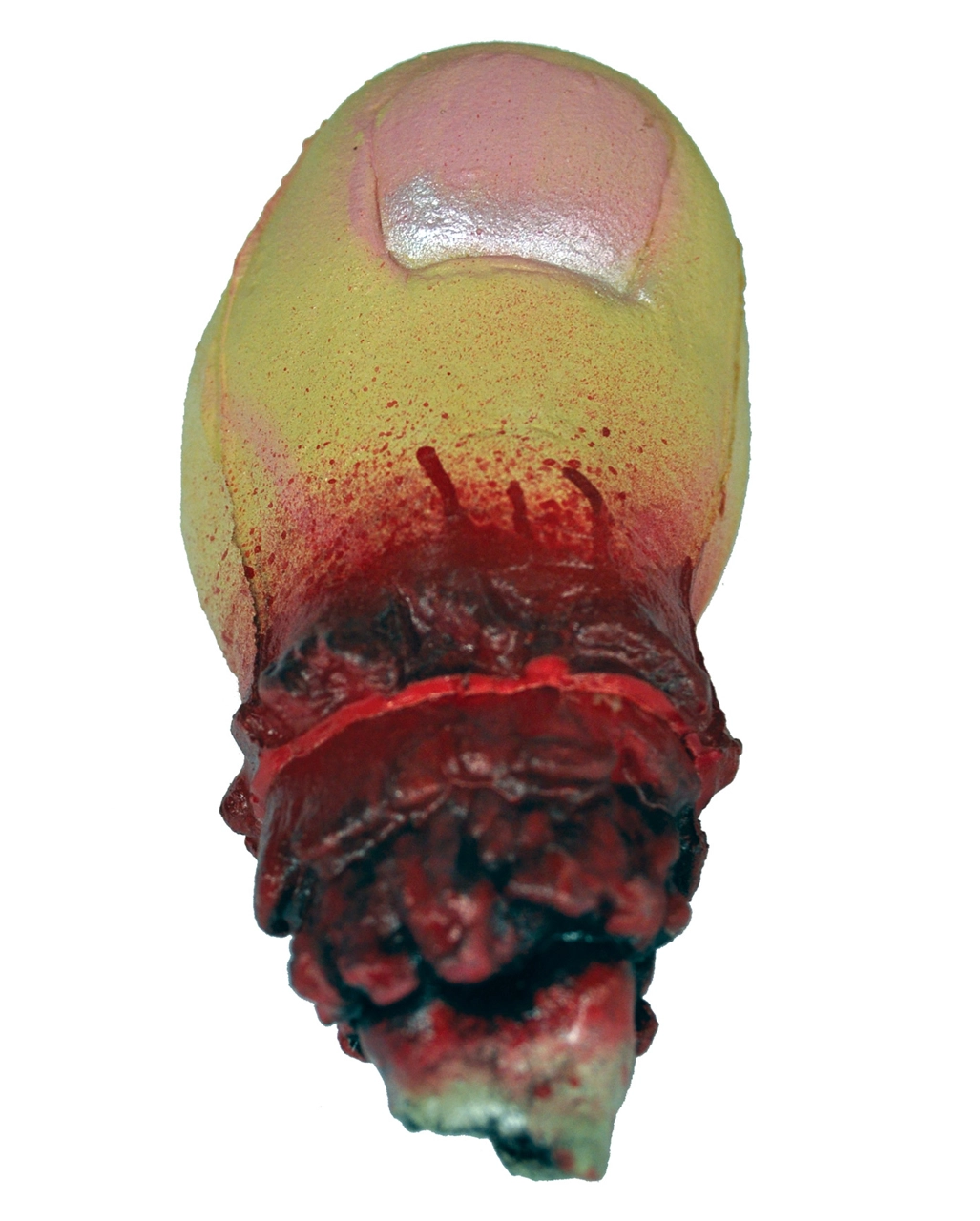 Blutige Zehe / Bloody Toe 3 Blutige Zehe / Bloody Toe